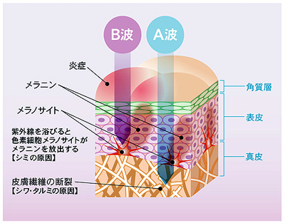 UVプロテクター(日焼け止め用ローション) <SPF18・PA++>30ml