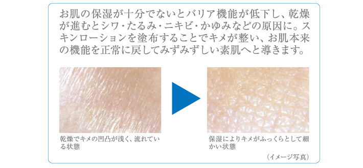 スキンローション比較